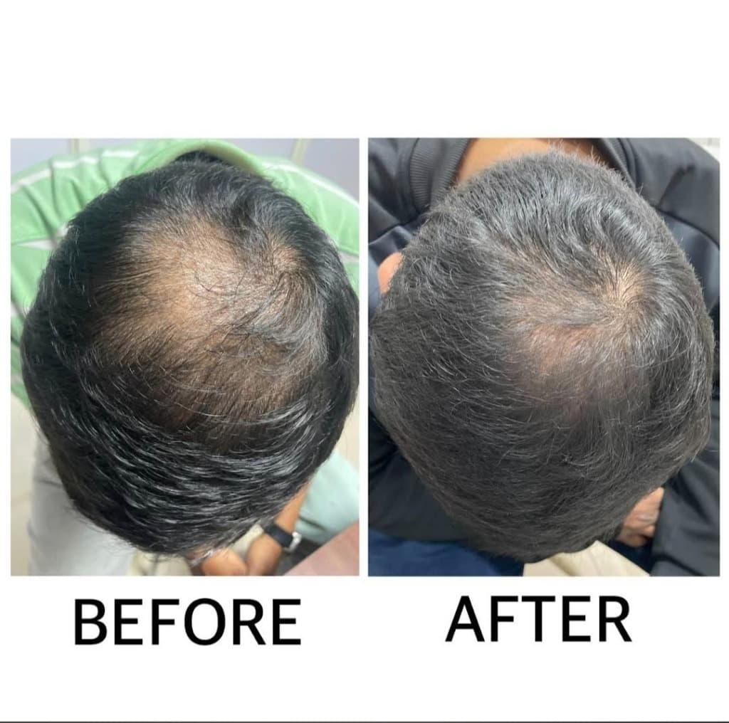 Treatment Result