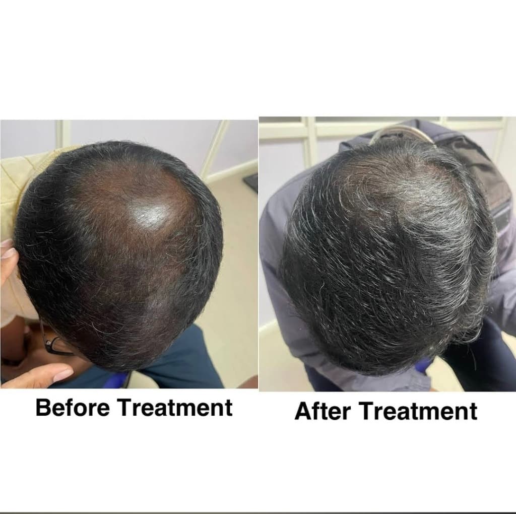 Treatment Result